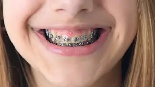 Children's Orthodontics