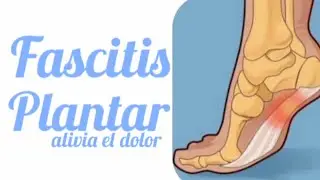 FASCITIS_PLANTAR_ALIVIA_el_DOLOR