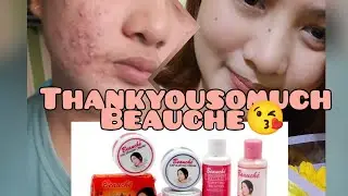 my acne journey and beauche&hearts;️