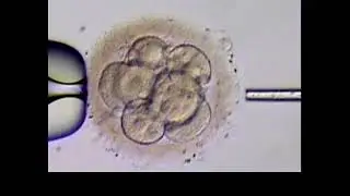 Assisted Hatching Using Acid Tyrodes