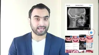 Instagram for dentists: Dr. Mohammed Sadekly