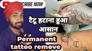 टैटू केसे हटाए।Permanent tattoo removal treatment।Khanna health care clinic#viralvideo #viralvideos