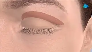 Blepharoplasty in Charleston WV | Mountain State Oral & Facial Surgery