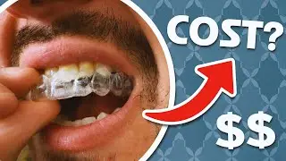 How Much Do Retainers Cost? (And When Should They Be Replaced)
