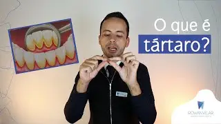 O que &eacute; t&aacute;rtaro?