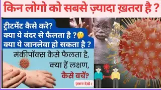 Monkeypox Explained: Symptoms, Causes, Treatment and Prevention | Complete Guide in हिन्दी 🦠।