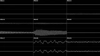 Pok&eacute;mon Diamond & Pearl (DS) - Route 209 (Day) - Oscilloscope Reconstruction