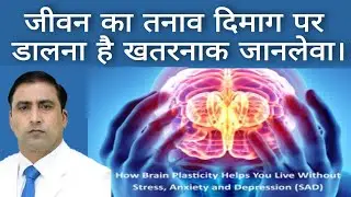 जीवन का तनाव दिमाग पर डालना है खतरनाक जानलेवा। || STRESS / BRAIN STROKE // Dr Kumar Education Clinic