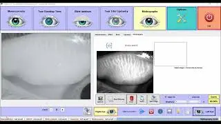 Meibography focus assist feature of OSDx