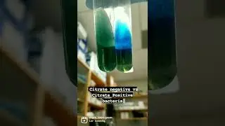 CITRATE NEGATIVE VS CITRATE POSITIVE BACTERIA #shorts #microbiology #biology #bacteria #phd #msc