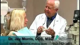 Mini Dental Implants - Dr. Jay Morris Kansas City Mini Dental Implant Center