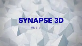 Synapse 3D - MR Brain Perfusion