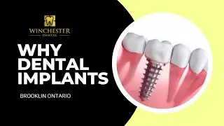 Dental Implants | WINCHESTER DENTAL | Whitby Dental Office, Ontario