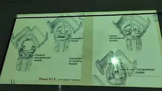 otorrino - anatom&iacute;a, fisiolog&iacute;a y patolog&iacute;a laringe 