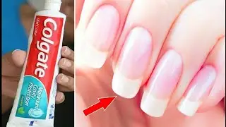 How to GROW NAILS FASTER (Results in LIVE Video), 100% WORKING ✔✔