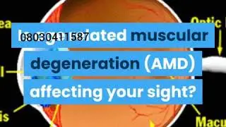 How TO Prevent EYE  problems