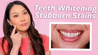 Why Your Teeth Won't Whiten (And Solutions for Stubborn Stains) | Dr. Joyce Kahng