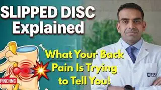 SLIPPED DISC Explained: What Your Back Pain Is Trying to Tell You! 💥🦴&rdquo;