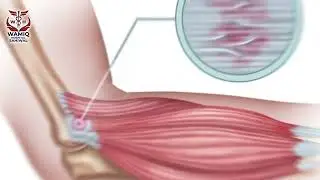 Joint Pain, Fractures & 24/7 Trauma Care | Wamiq Hospital Sahiwal