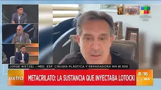 Metacrilato: la sustancia que inyectaba An&iacute;bal Lotocki