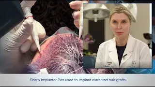 Direct Hair Implantation (DHI) - Promotional vs Proprietary Terms
