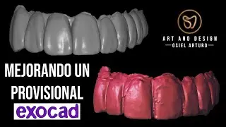 MEJORA DE UN PROVISIONAL EN PMMA/EXOCAD