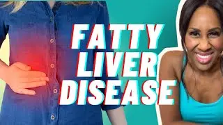 What is Fatty Liver Disease? How Dangerous is it and How is it Treated?  Doctor Explains