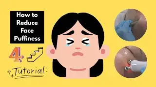 How to Reduce Face Swelling in 4 Steps | Face Puffiness Reduction Techniques