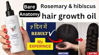 Bare Anatomy Rosemary Hibiscus Hair Growth Oil | Bare anatomy hair growth oil | Reveiw