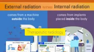 #radiotherapy equipments #EBRT and brachytherapy introductions //Types// Cobalt-60