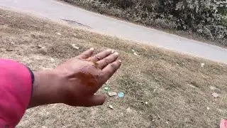 आज सुबह सुबह हाथ में चोट लग गई 😭😭😭।।