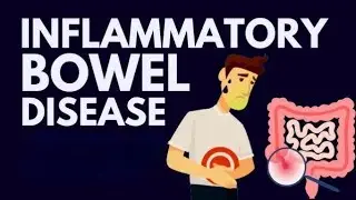 Inflammatory Bowel Disease | आंतों में सूजन #intestine #ulcerativecolitis