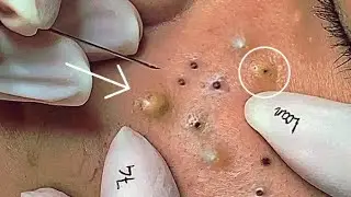 Satisfying Hien Spa Beauty Relaxing Video #28(5)