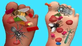 Foot Clinic - Gameplay Walkthrough - All Levels (IOS, Android)