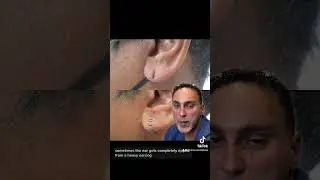 Earlobe Repair