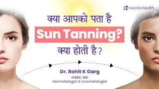 Sun tanning | Causes and home remedies| Meddo Health | Dr. Rohit Garg