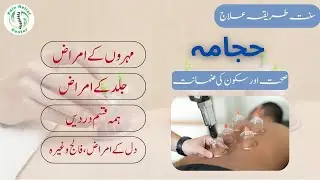 Hijama Therapy Treatment | Cupping Therapy | Hijama in Islam | Pain Relief Center | Ost Usman Sohail