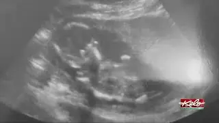 A birth mother&rsquo;s story of growing through open adoption