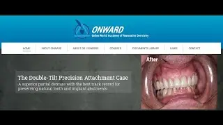 About the ONWARD Program
