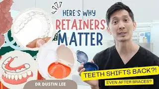 Why Teeth Shift After Braces | The Truth About Clear Retainers