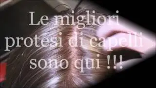 Le migliori protesi di capelli al mondo - HRS