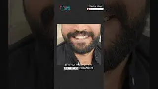 Dental Implants in Meerut | Fixed Teeth in 3 Days | ReFace Dental Clinic | Dr. Gaurav Dhaka