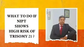 WHAT TO DO IF NIPT SHOWS HIGH RISK OF TRISOMY 21 ?
