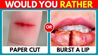 Would You Rather Extreme Edition 😱 | Hardest Choices Ever & Impossible Fun Challenge