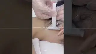 Smooth Skin Routine for Every Woman #skincare #thebarbersarms #laser