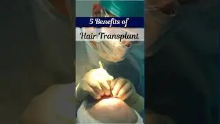 Benifit of hair transplant | #HairTransplant #AestheticCare