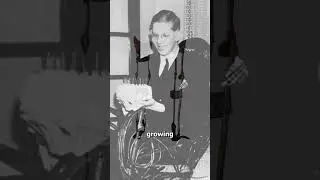 The Tragic Story Of The World's Tallest Man 🙁 (sad)