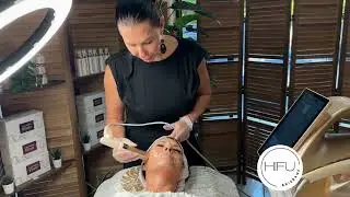HIFU skin tightening treatments
