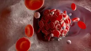 Jacksonville cardiologist: Blood clots reported after J&J vaccine &lsquo;very rare&rsquo;