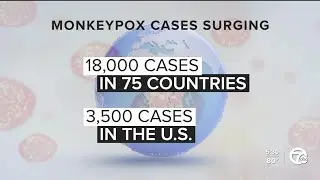 US monkeypox cases are among the highest in the world, CDC says
